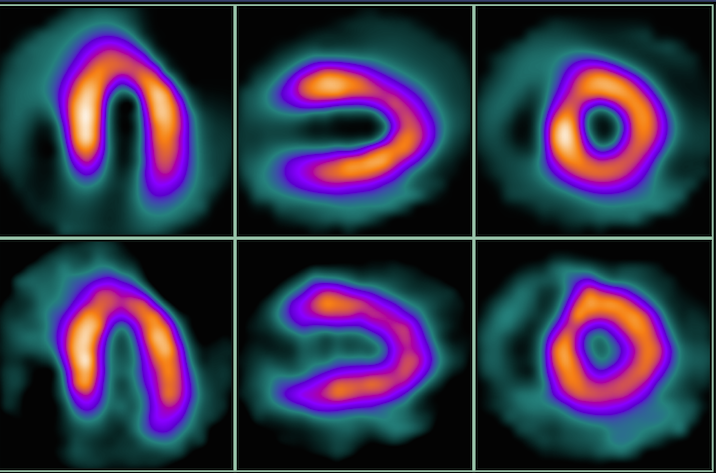 Managing Dose in PET and SPECT Myocardial Perfusion Imaging | DAIC